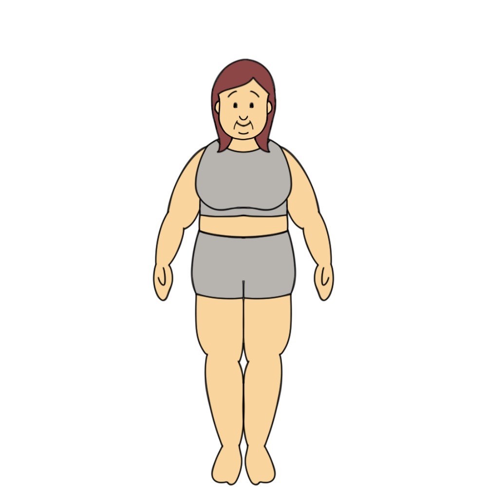 158cmのBMI35以上40未満の女性見た目