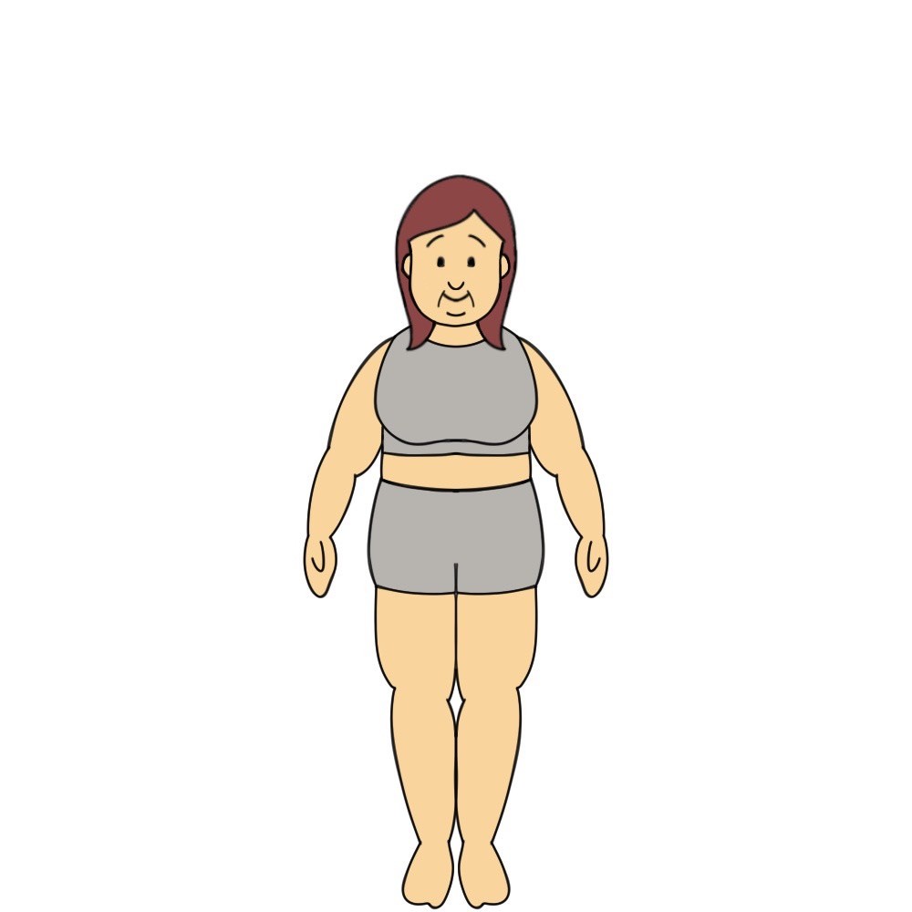 141cmのBMI35以上40未満の女性見た目